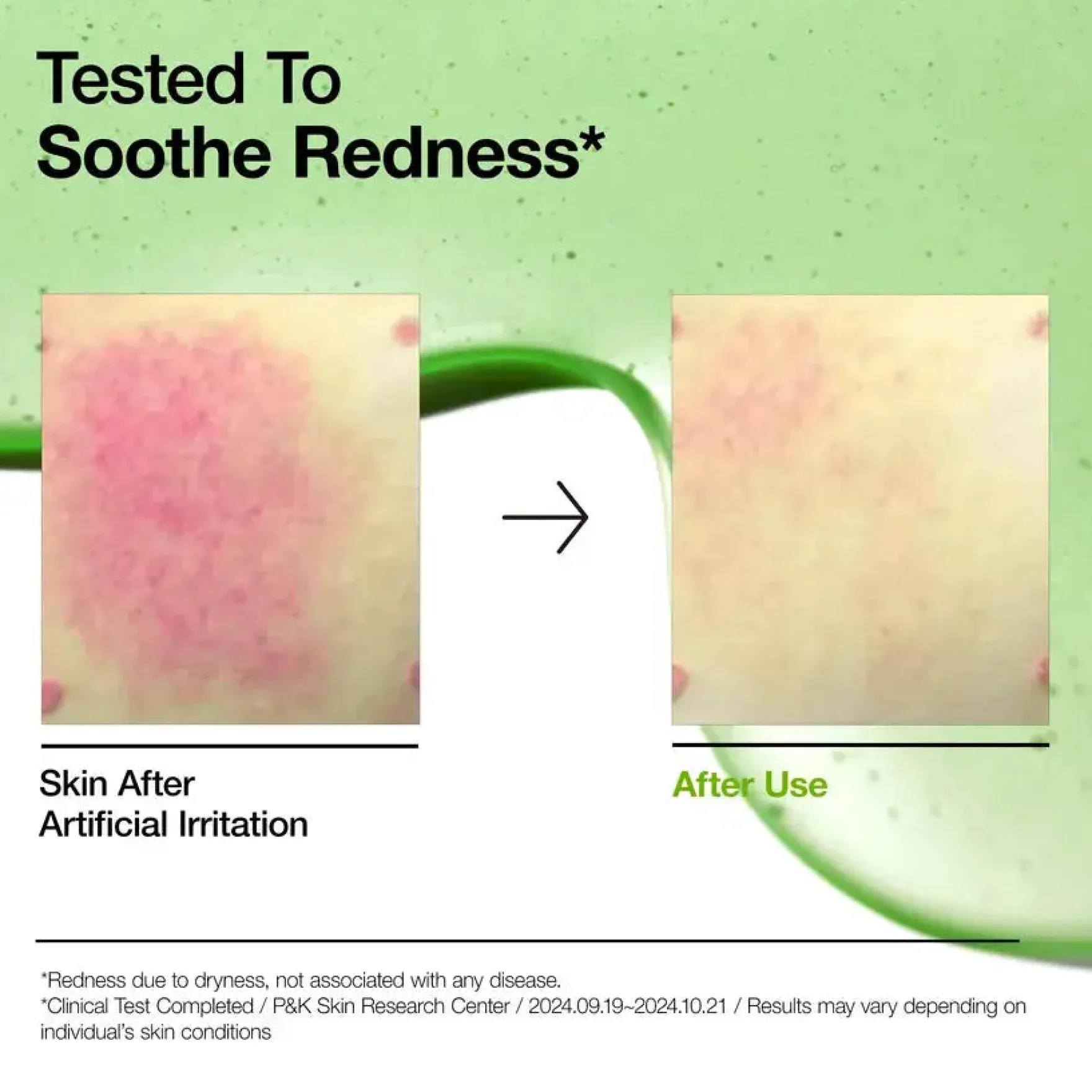 Azelaic Acid 10 Hyaluron Redness Soothing Serum