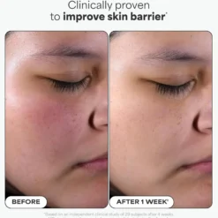BHA Liquid Exfoliant