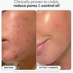 BHA Liquid Exfoliant 30 ml.
