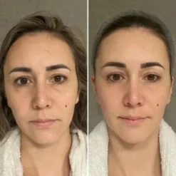 Collagen Tripeptide & Vitamine C