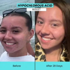 Hypochlorous Cleansing Spray